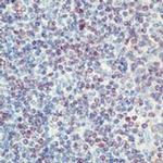 Cdc25A Antibody in Immunohistochemistry (Paraffin) (IHC (P))