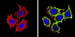 IGF1R beta Antibody in Immunocytochemistry (ICC/IF)