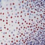 XPA Antibody in Immunohistochemistry (Paraffin) (IHC (P))