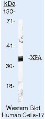 XPA Antibody in Western Blot (WB)