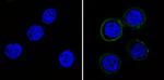 P-Glycoprotein Monoclonal Antibody (F4)