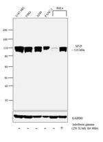 MVP Antibody in Western Blot (WB)