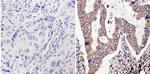 ERCC1 Antibody in Immunohistochemistry (Paraffin) (IHC (P))