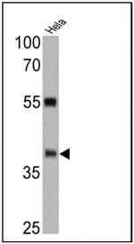 ERCC1 Antibody in Western Blot (WB)