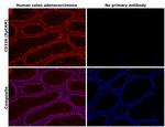 EpCAM Antibody in Immunohistochemistry (Paraffin) (IHC (P))
