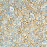 EpCAM Antibody in Immunohistochemistry (Paraffin) (IHC (P))