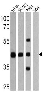 EpCAM Antibody in Western Blot (WB)