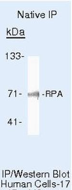 RPA70 Antibody in Immunoprecipitation (IP)