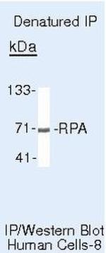 RPA70 Antibody in Immunoprecipitation (IP)