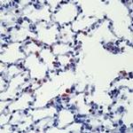 SFTPB Precursor Antibody in Immunohistochemistry (Paraffin) (IHC (P))