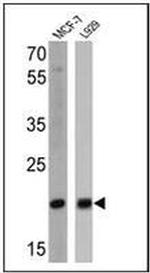 Bax Antibody in Western Blot (WB)