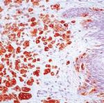 Melan-A Antibody in Immunohistochemistry (Paraffin) (IHC (P))