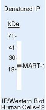 Melan-A Antibody in Immunoprecipitation (IP)