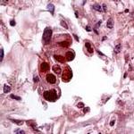 Cytomegalovirus Antibody in Immunohistochemistry (IHC)