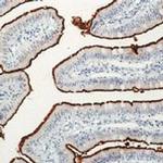 CD10 Antibody in Immunohistochemistry (Paraffin) (IHC (P))