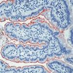 CD10 Antibody in Immunohistochemistry (Paraffin) (IHC (P))