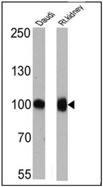 CD10 Antibody in Western Blot (WB)
