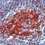 CD23 Antibody in Immunohistochemistry (Paraffin) (IHC (P))