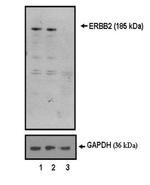 ErbB2 (HER-2) Antibody