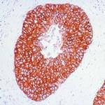 ErbB2 (HER-2) Antibody in Immunohistochemistry (Paraffin) (IHC (P))