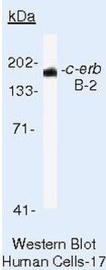 ErbB2 (HER-2) Antibody in Western Blot (WB)