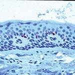 CD1a Antibody in Immunohistochemistry (Paraffin) (IHC (P))