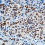 MiTF Antibody in Immunohistochemistry (IHC)