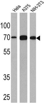 MiTF Antibody in Western Blot (WB)