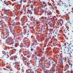 Melan-A Antibody in Immunohistochemistry (IHC)