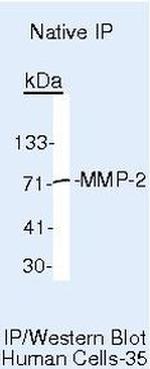 MMP2 Antibody in Immunoprecipitation (IP)