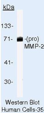 MMP2 Antibody in Western Blot (WB)