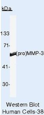 MMP3 Antibody in Western Blot (WB)