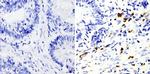 MMP9 Antibody in Immunohistochemistry (Paraffin) (IHC (P))