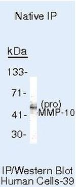 MMP10 Antibody in Immunoprecipitation (IP)