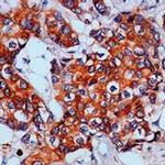 p130Cas Antibody in Immunohistochemistry (IHC)