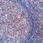 CDKN2C Antibody in Immunohistochemistry (Paraffin) (IHC (P))