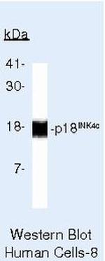 CDKN2C Antibody in Western Blot (WB)