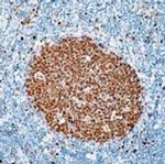 MCM7 Antibody in Immunohistochemistry (IHC)