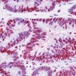 p130 Antibody in Immunohistochemistry (Paraffin) (IHC (P))