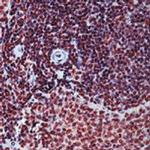 p130 Antibody in Immunohistochemistry (Paraffin) (IHC (P))
