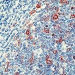 Cyclin B1 Antibody in Immunohistochemistry (Paraffin) (IHC (P))