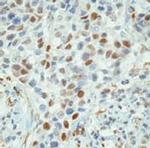 Cyclin E Antibody in Immunohistochemistry (IHC)