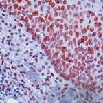 E2F1 Antibody in Immunohistochemistry (Paraffin) (IHC (P))