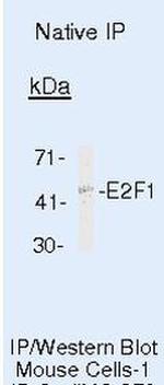E2F1 Antibody in Immunoprecipitation (IP)