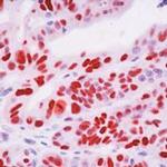 p21 Antibody in Immunohistochemistry (IHC)