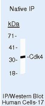 p21 Antibody in Immunoprecipitation (IP)