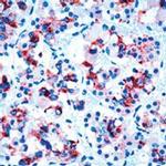 Prolactin Antibody in Immunohistochemistry (IHC)
