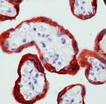 c-Abl Antibody in Immunohistochemistry (IHC)