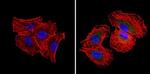 RAD51 Antibody in Immunocytochemistry (ICC/IF)