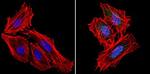RAD51 Antibody in Immunocytochemistry (ICC/IF)